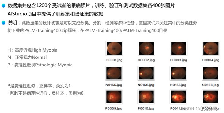 卷积神经网络(CNN)基于SqueezeNet的眼疾识别功能